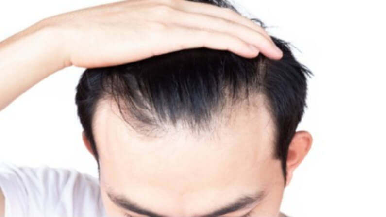 Reternhair - 3 elasticity Low - If the hair has a hard time