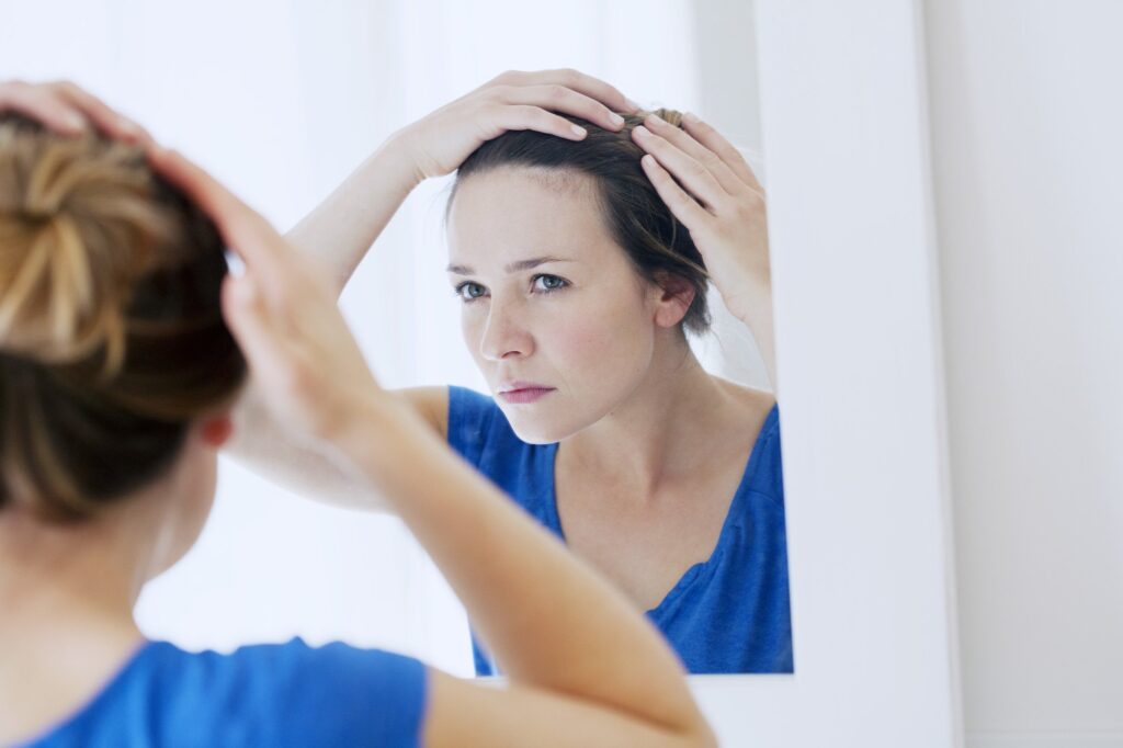 uneven hairline